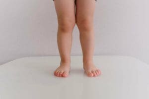 Normal Alignment of the Lower Extremity in Youth