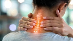 Managing Cervical Radiculopathy