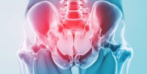 Adult Hip Dysplasia